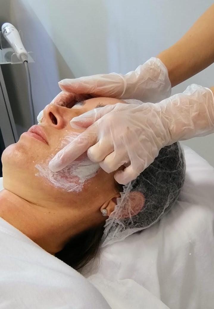 Clareamento Facial