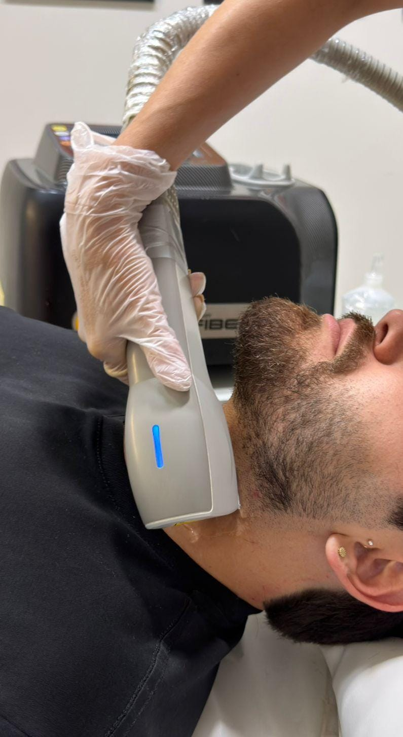 Depilação a Laser