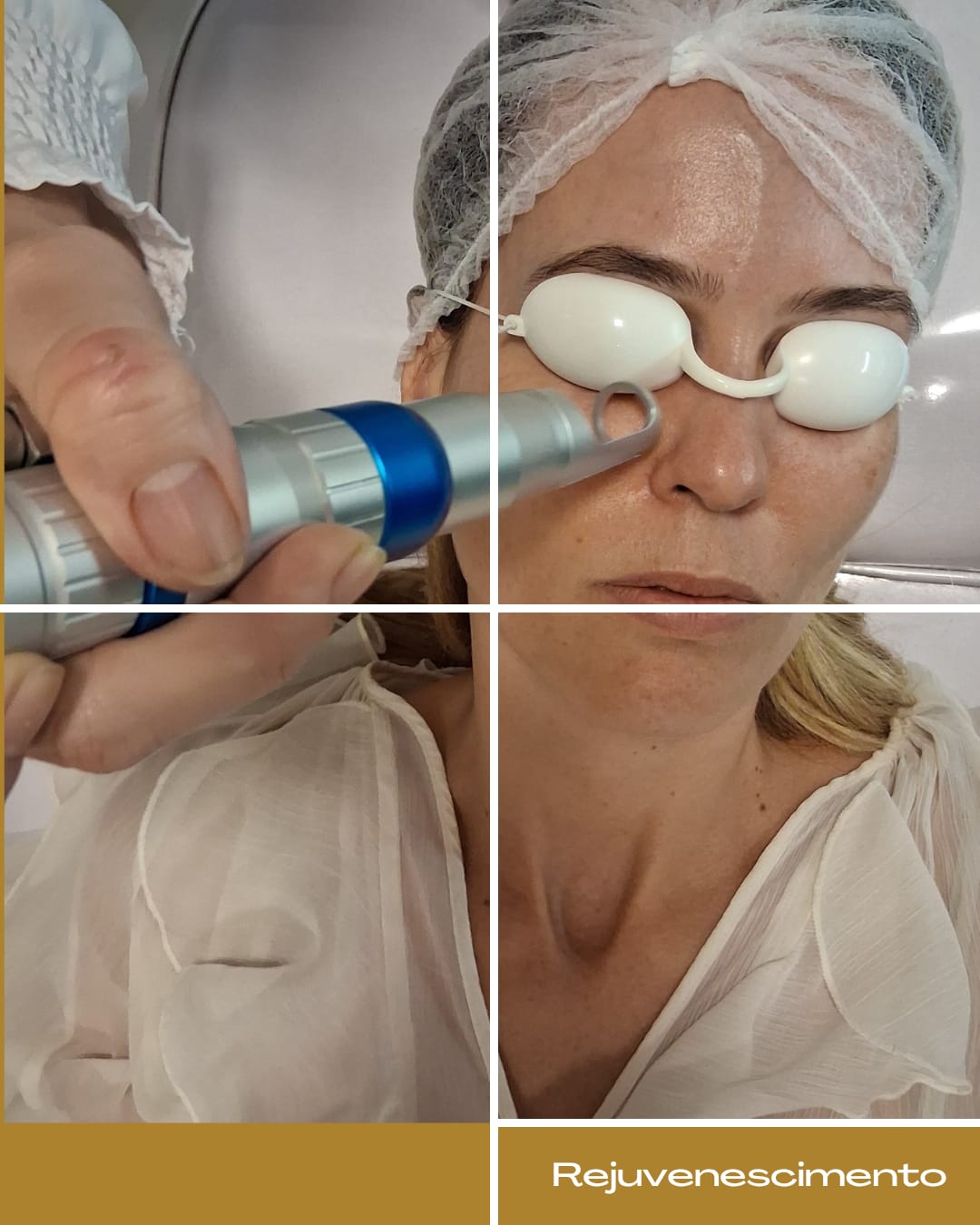 Rejuvenescimento com Helius