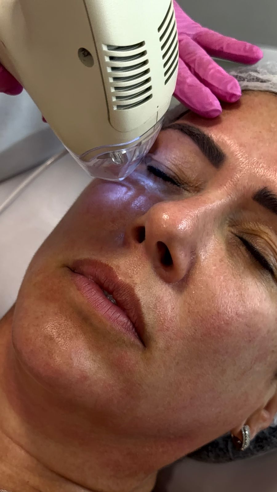 TIXEL - Tratamento Facial